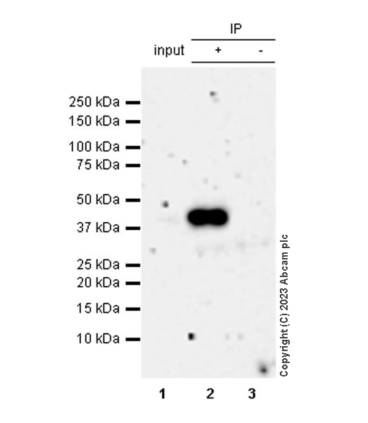 Immunoprecipitation - Anti-Mycobacterium tuberculosis Ag85B antibody [EPR28401-54] (ab312328), expandable thumbnail
