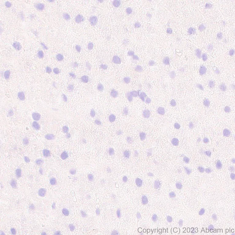 Immunohistochemistry (Formalin/PFA-fixed paraffin-embedded sections) - Anti-Mycobacterium tuberculosis Ag85B antibody [EPR28401-54] - BSA and Azide free (AB312329)