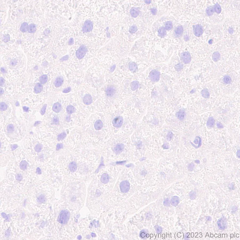 Immunohistochemistry (Formalin/PFA-fixed paraffin-embedded sections) - Anti-Mycobacterium tuberculosis Ag85B antibody [EPR28401-54] - BSA and Azide free (AB312329)