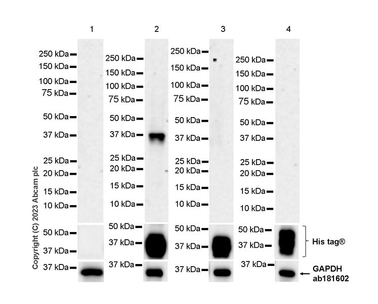 Western blot - Anti-Mycobacterium tuberculosis Ag85B antibody [EPR28401-54] - BSA and Azide free (AB312329), expandable thumbnail