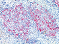 Immunohistochemistry (Formalin/PFA-fixed paraffin-embedded sections) - Anti-Mycobacterium tuberculosis antibody (AB905), expandable thumbnail
