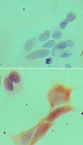 Immunocytochemistry/ Immunofluorescence - Anti-MyD88 antibody [4D6] (AB107585)