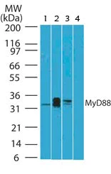 Western blot - Anti-MyD88 antibody [4D6] (AB107585)