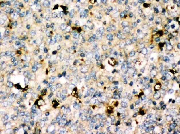 Immunohistochemistry (Formalin/PFA-fixed paraffin-embedded sections) - Anti-MyD88 antibody (AB131071), expandable thumbnail