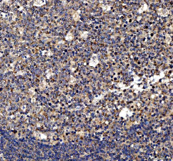 Immunohistochemistry (Formalin/PFA-fixed paraffin-embedded sections) - Anti-MyD88 antibody (AB131071)