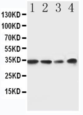 Western blot - Anti-MyD88 antibody (AB131071), expandable thumbnail