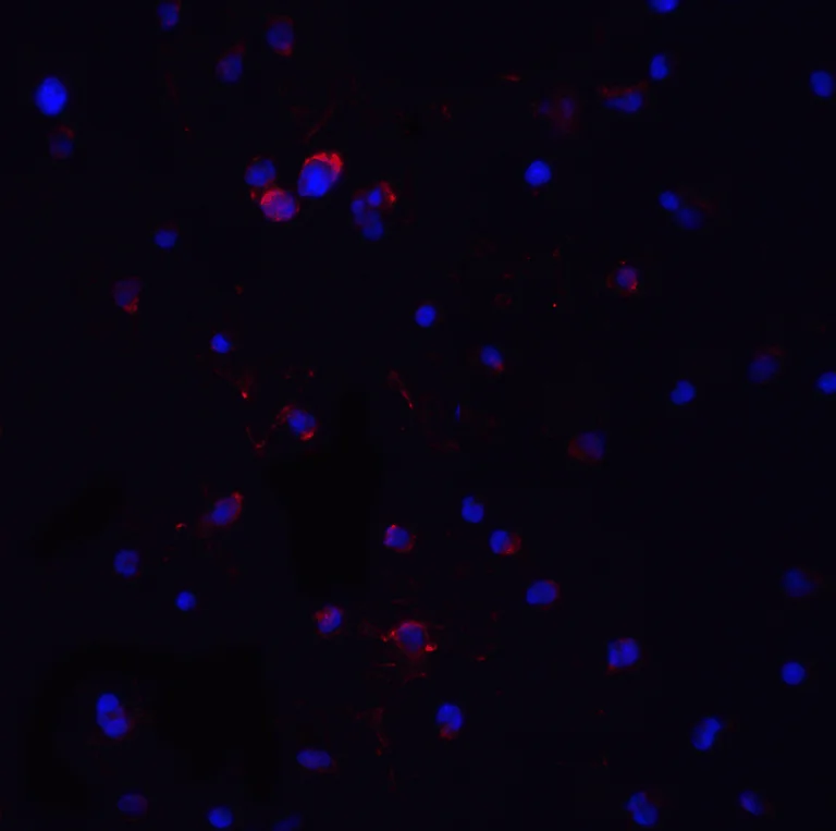 Anti-MyD88 antibody (ab2064) | Abcam