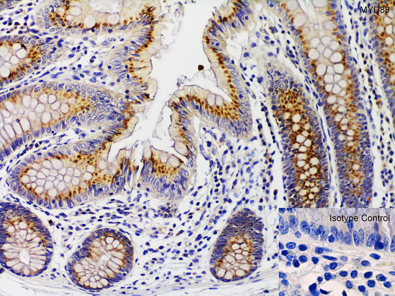 Immunohistochemistry (Formalin/PFA-fixed paraffin-embedded sections) - Anti-MyD88 antibody (AB2064)