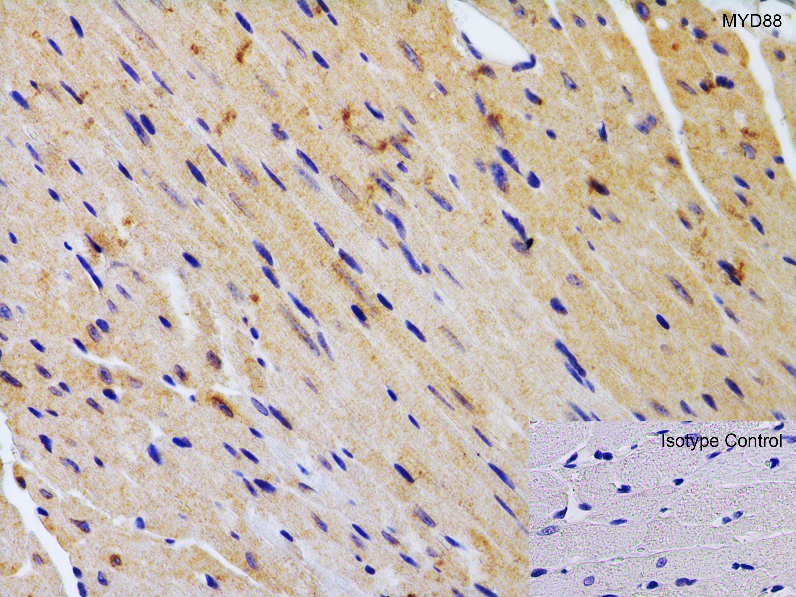 Immunohistochemistry (Formalin/PFA-fixed paraffin-embedded sections) - Anti-MyD88 antibody (ab2064), expandable thumbnail