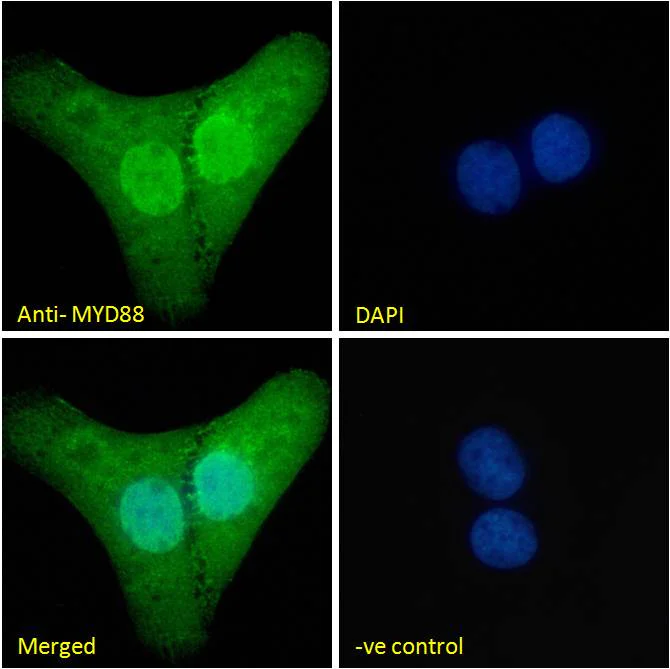 Immunocytochemistry/ Immunofluorescence - Anti-MyD88 antibody (AB28763)