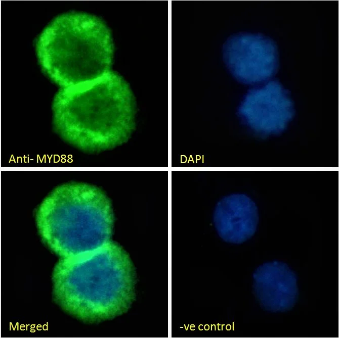Immunocytochemistry/ Immunofluorescence - Anti-MyD88 antibody (AB28763)