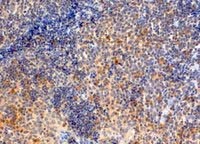 Immunohistochemistry (Formalin/PFA-fixed paraffin-embedded sections) - Anti-MyD88 antibody (AB28763)
