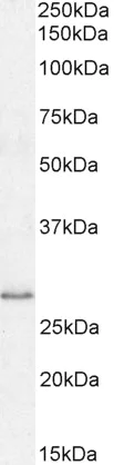 Western blot - Anti-MyD88 antibody (AB28763)