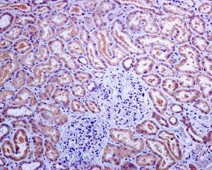 Immunohistochemistry (Formalin/PFA-fixed paraffin-embedded sections) - Anti-MyD88 antibody [EPR590(N)] (AB133739)