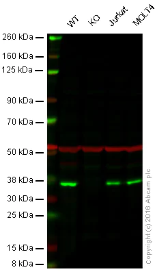 Western blot - Anti-MyD88 antibody [EPR590(N)] (AB133739)