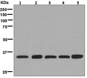 Western blot - Anti-MyD88 antibody [EPR590(N)] (AB133739)