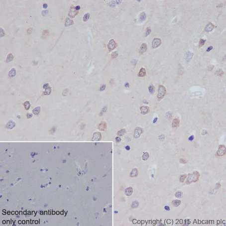 Immunohistochemistry (Formalin/PFA-fixed paraffin-embedded sections) - Anti-MyD88 antibody [EPR590(N)] - BSA and Azide free (AB199247)