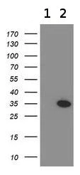 Western blot - Anti-MyD88 antibody [OTI1B4] (AB119048)