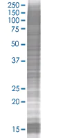 SDS-PAGE - MyD88 overexpression 293T lysate (whole cell) (AB94066)