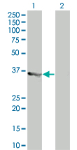 Western blot - MyD88 overexpression 293T lysate (whole cell) (AB94066), expandable thumbnail