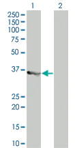 Western blot - MyD88 overexpression 293T lysate (whole cell) (AB94066)