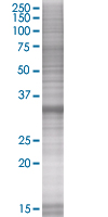 SDS-PAGE - MyD88 overexpression 293T lysate (whole cell) (AB94067), expandable thumbnail
