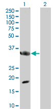 Western blot - MyD88 overexpression 293T lysate (whole cell) (AB94067), expandable thumbnail