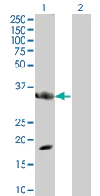 Western blot - MyD88 overexpression 293T lysate (whole cell) (AB94067)