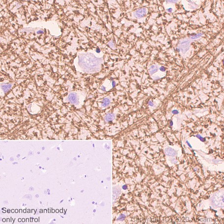 Immunohistochemistry (Formalin/PFA-fixed paraffin-embedded sections) - Anti-Myelin Basic Protein antibody [12] (AB7349), expandable thumbnail