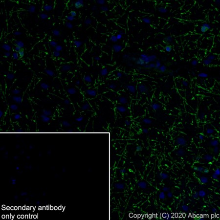 Immunohistochemistry (Formalin/PFA-fixed paraffin-embedded sections) - Anti-Myelin Basic Protein antibody [12] (AB7349), expandable thumbnail