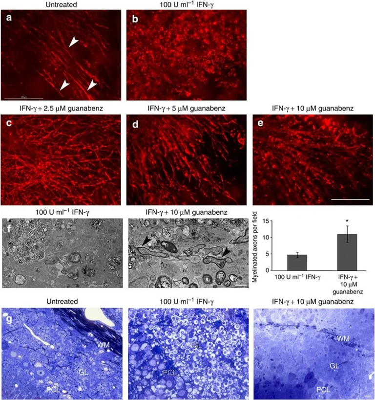 Immunofluorescence - Anti-Myelin Basic Protein antibody [12] - Oligodendrocyte Marker (AB7349)