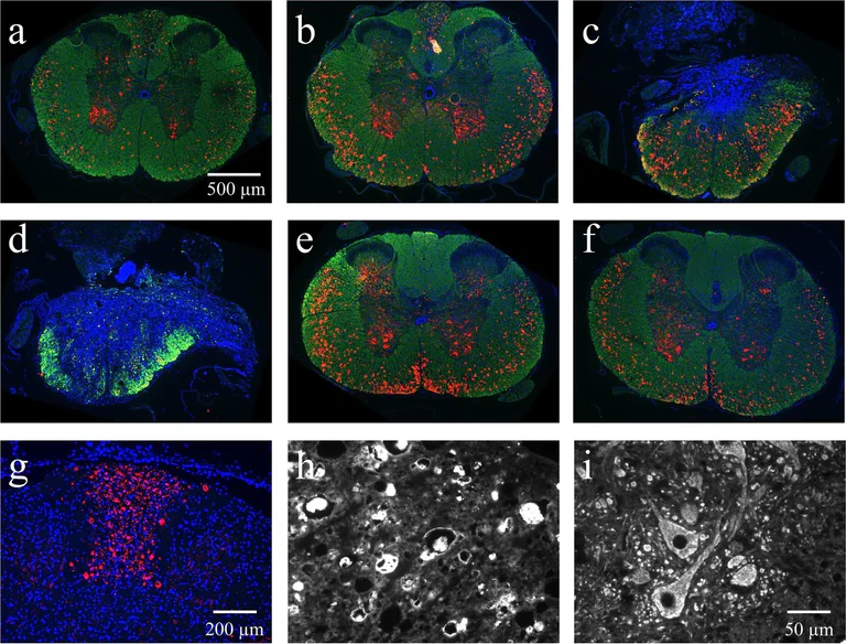 Immunohistochemistry - Anti-Myelin Basic Protein antibody [12] - Oligodendrocyte Marker (AB7349)
