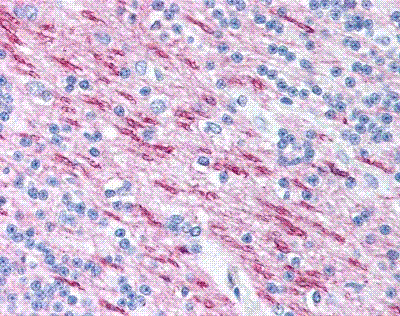 Immunohistochemistry (Formalin/PFA-fixed paraffin-embedded sections) - Anti-Myelin Basic Protein antibody [22] (AB11223), expandable thumbnail