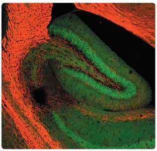 Immunohistochemistry (Formalin/PFA-fixed paraffin-embedded sections) - Anti-Myelin Basic Protein antibody (AB134018)