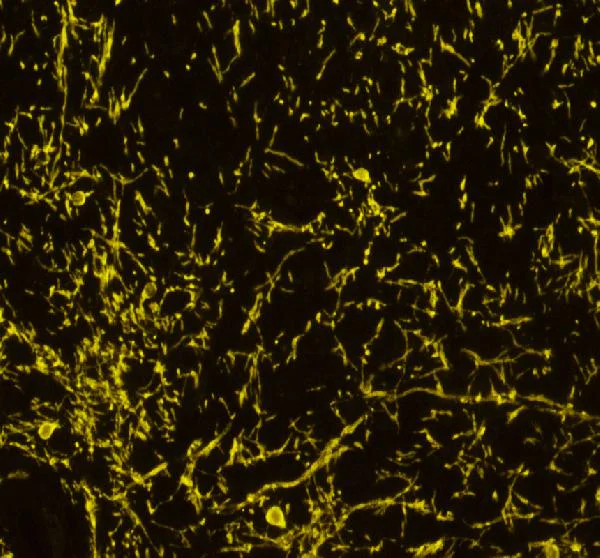 Immunocytochemistry/ Immunofluorescence - Anti-Myelin Basic Protein antibody (AB65988)