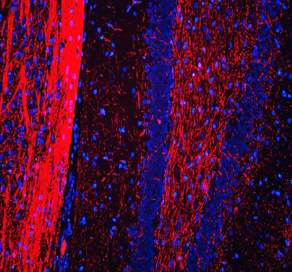 Immunocytochemistry/ Immunofluorescence - Anti-Myelin Basic Protein antibody (AB65988)