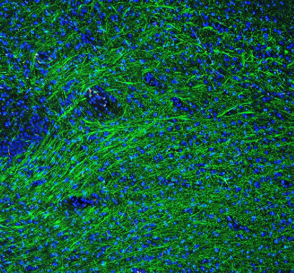 Immunocytochemistry/ Immunofluorescence - Anti-Myelin Basic Protein antibody (AB65988)