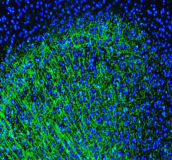 Immunocytochemistry/ Immunofluorescence - Anti-Myelin Basic Protein antibody (AB65988)