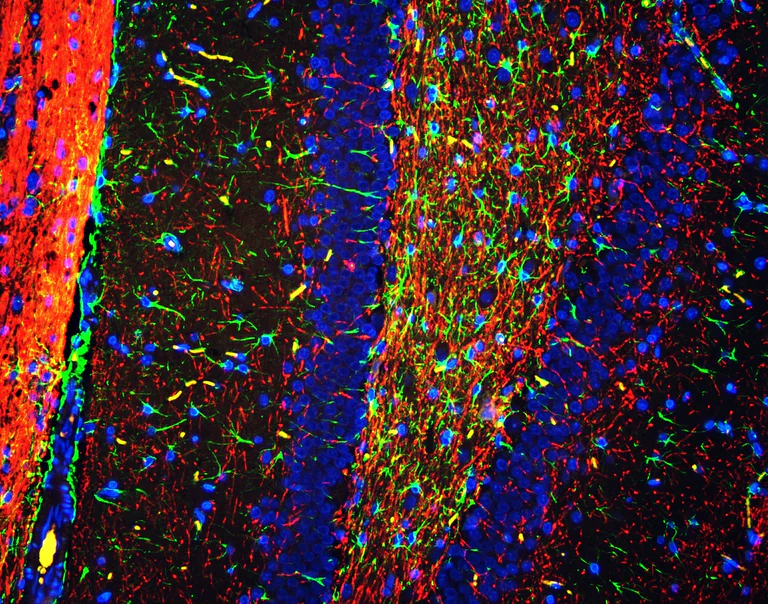 Anti-Myelin Basic Protein antibody (ab65988) | Abcam