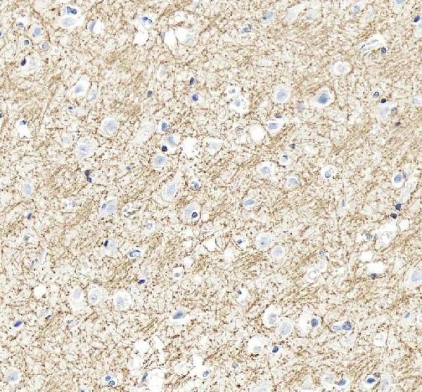 Immunohistochemistry (Formalin/PFA-fixed paraffin-embedded sections) - Anti-Myelin Basic Protein antibody (AB65988)