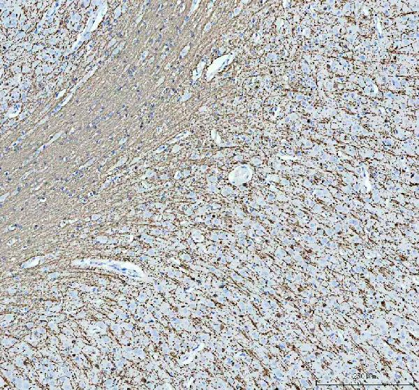 Immunohistochemistry (Formalin/PFA-fixed paraffin-embedded sections) - Anti-Myelin Basic Protein antibody (AB65988)