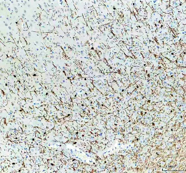 Immunohistochemistry (Formalin/PFA-fixed paraffin-embedded sections) - Anti-Myelin Basic Protein antibody (AB65988)