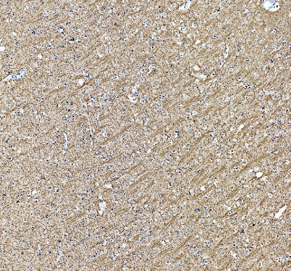 Immunohistochemistry (Formalin/PFA-fixed paraffin-embedded sections) - Anti-Myelin Basic Protein antibody (AB65988)