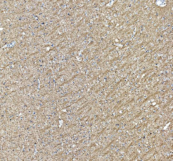 Immunohistochemistry (Formalin/PFA-fixed paraffin-embedded sections) - Anti-Myelin Basic Protein antibody (AB65988)