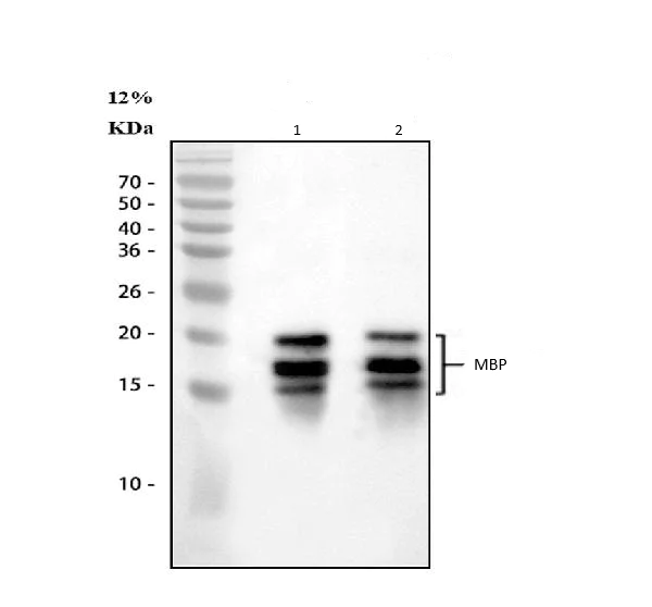 Western blot - Anti-Myelin Basic Protein antibody (AB65988)