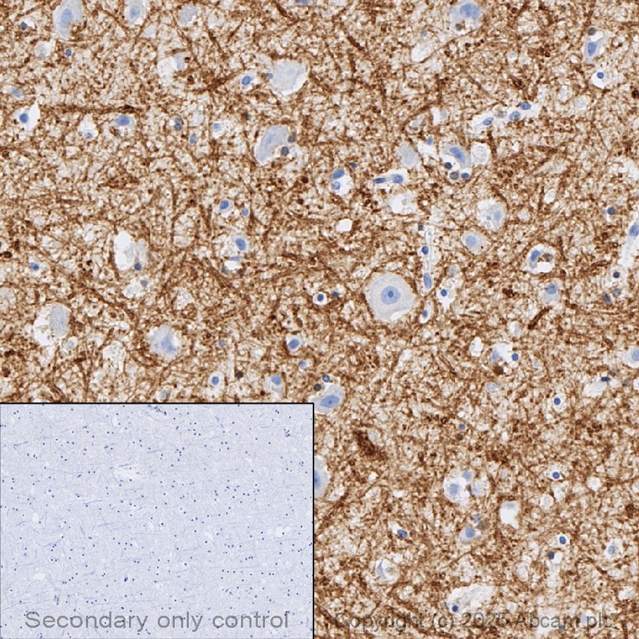 Immunohistochemistry (Formalin/PFA-fixed paraffin-embedded sections) - Anti-Myelin Basic Protein antibody [EPR21188] (ab218011), expandable thumbnail