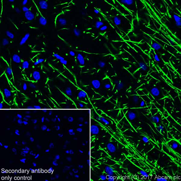 Immunohistochemistry (Frozen sections) - Anti-Myelin Basic Protein antibody [EPR21188] (AB218011), expandable thumbnail