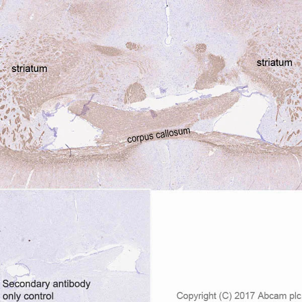 Immunohistochemistry (Formalin/PFA-fixed paraffin-embedded sections) - Anti-Myelin Basic Protein antibody [EPR21188] - Oligodendrocyte Marker (AB218011)