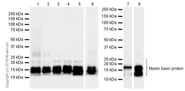 Western blot - Anti-Myelin Basic Protein antibody [EPR21188] - Oligodendrocyte Marker (AB218011)