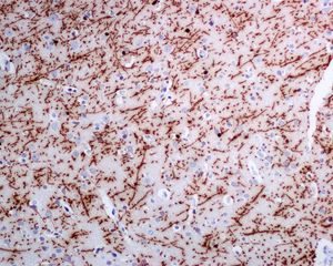 Anti-Myelin Basic Protein antibody [EPR6652]